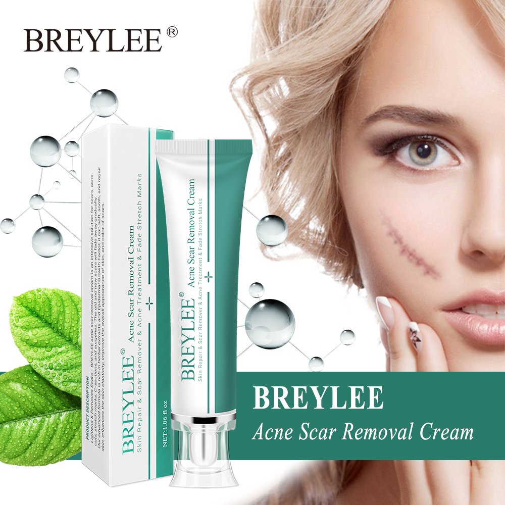 BREYLEE Acne Scar Removal Cream 30g Face Cream Skin Repair Skin Care Scar Acne Treatment Remove Stretch Marks Whitening Cream