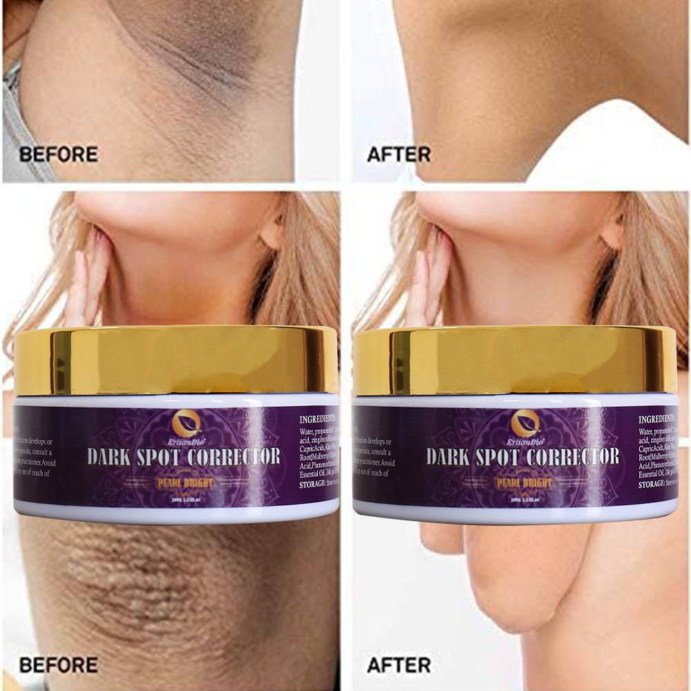 Hot selling product black spot removal cream underarm whitening brightening removing blemishes skin whitening cream