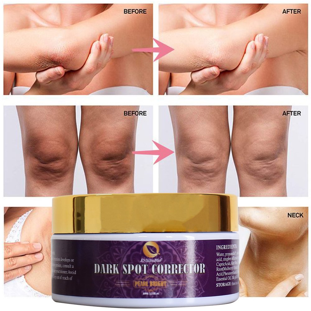 Hot selling product black spot removal cream underarm whitening brightening removing blemishes skin whitening cream