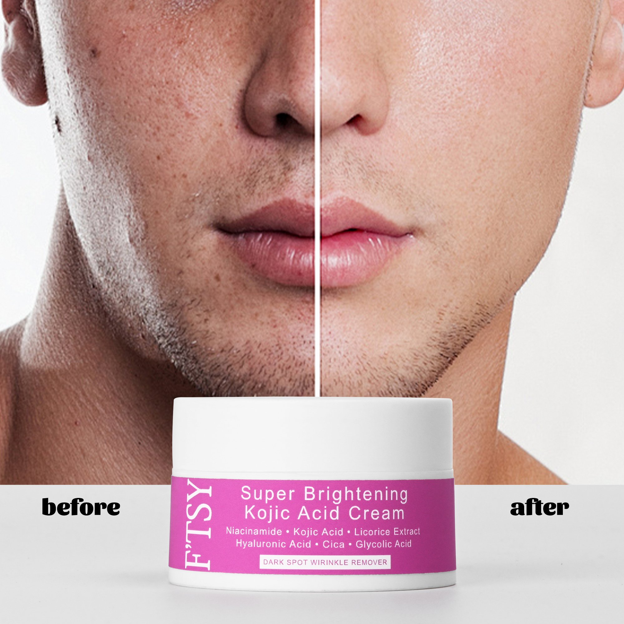 OEM Cica Kojic Acid Face Cream Niacinamide Licorice Extract Deep Nourishing Hydrating Anti Wrinkle Whitening Cream