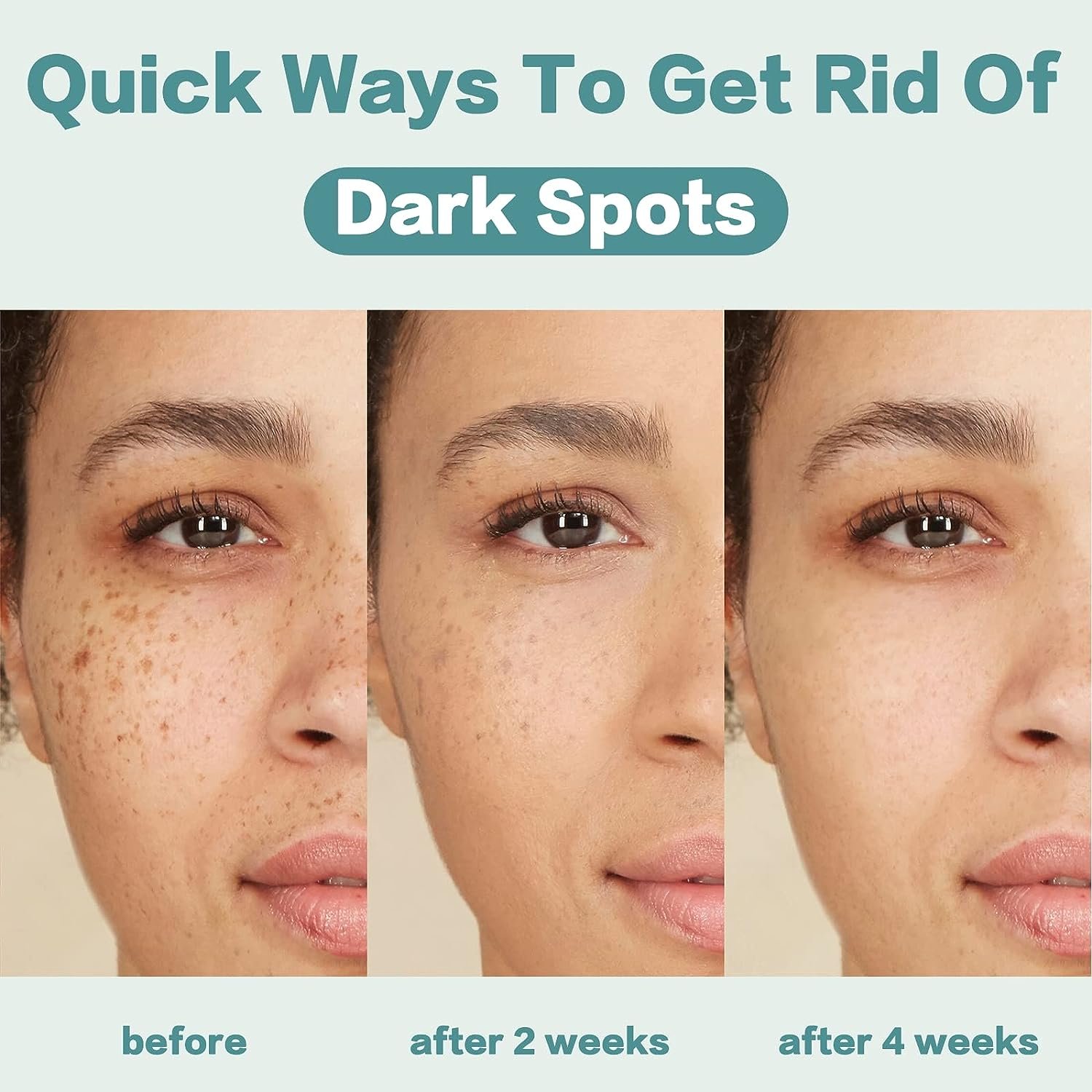 hottest Yunnan whitening pimples and dark spot freckle removal corrector repairing moisturizing spot fading herbal face cream