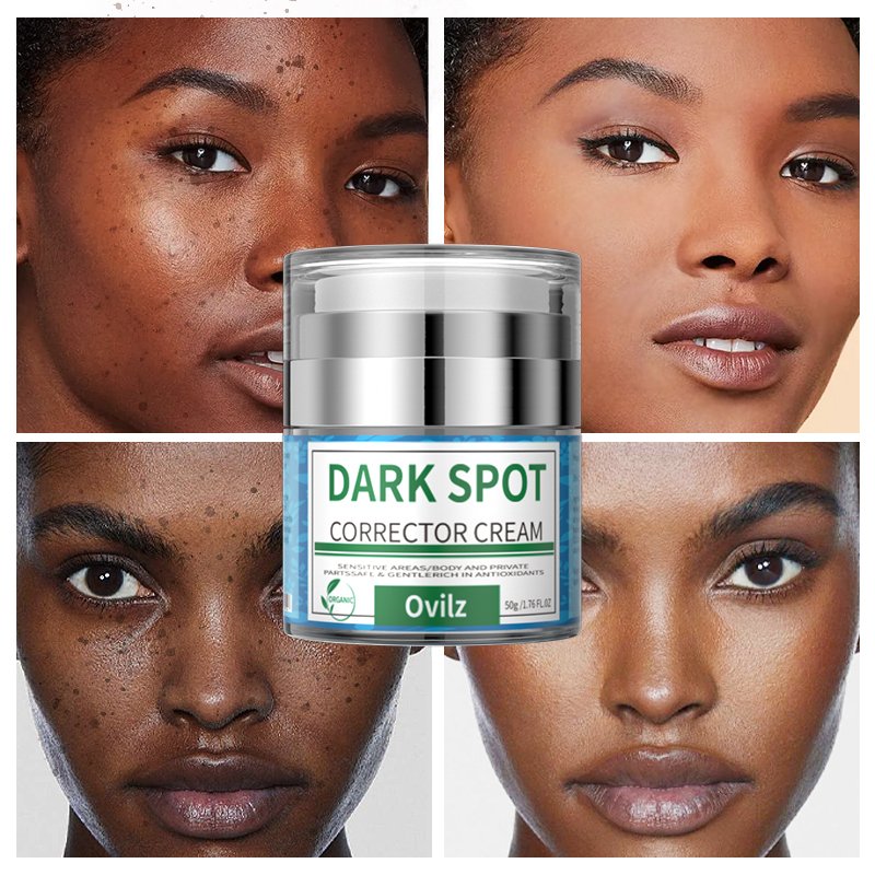 Beauty Skin Care Face Black Freckle Acne Fade Dark Spot Removing Corrector Anti Freckle cream For All Skin Types