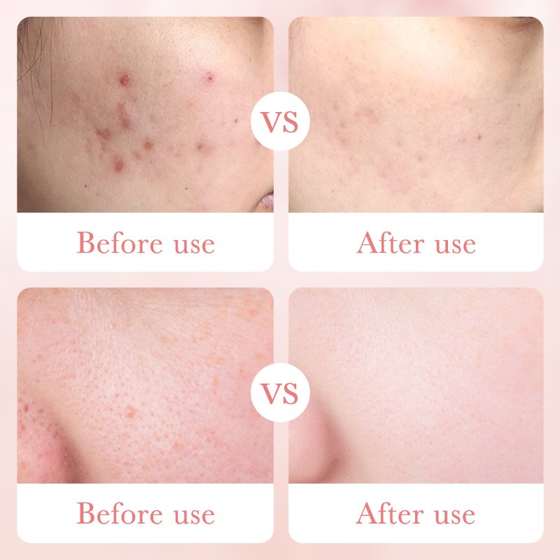 Private Label beauty products BIOAQUA Organic Skin Care Shrink Pores Rose Hyaluronic Acid Moisturizing face cream