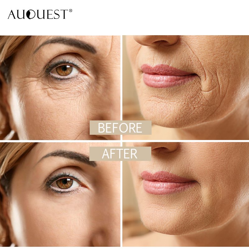 AuQuest Private label organic Vegan Moisturizing Whitening Shrink Pores Oil Control 5 Second Wrinkle Remover face cream