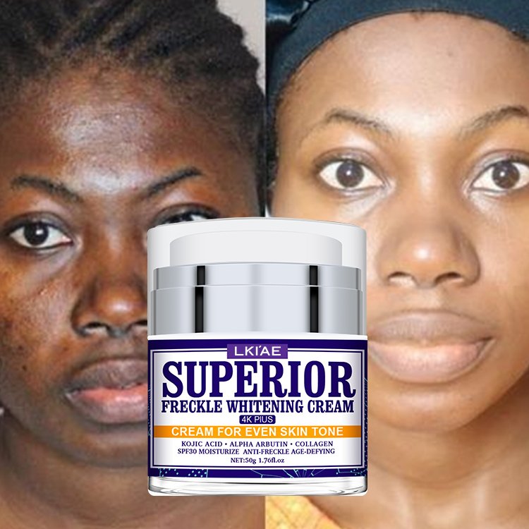 Natural Face Cream Organic Skin Whitening Face Cream Beauty Dark Spot Anti Aging Moisturizer Dark knuckle Cream