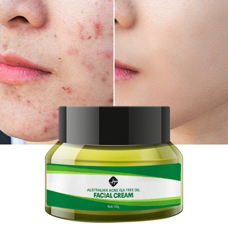 Private Labels Anti Aging Cream and Wrinkles Face Cream Organic Kojic Acid Vitamin C Whitening Facial Cream