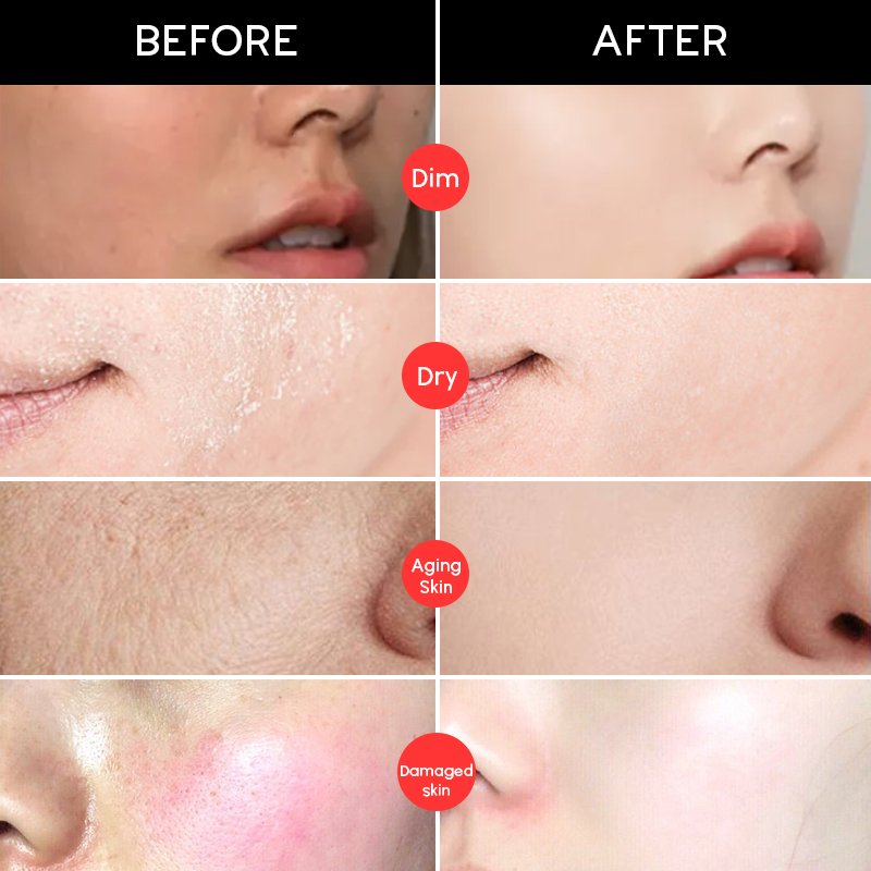 Private Labels Anti Aging Cream and Wrinkles Face Cream Organic Kojic Acid Vitamin C Whitening Facial Cream