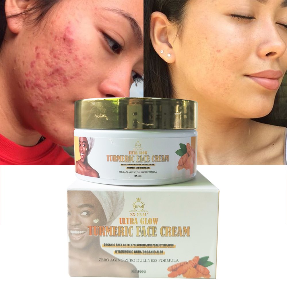 OEM hot selling product best turmeric face cream natural increment skin acne removing spot turmeric vitamin C face cream
