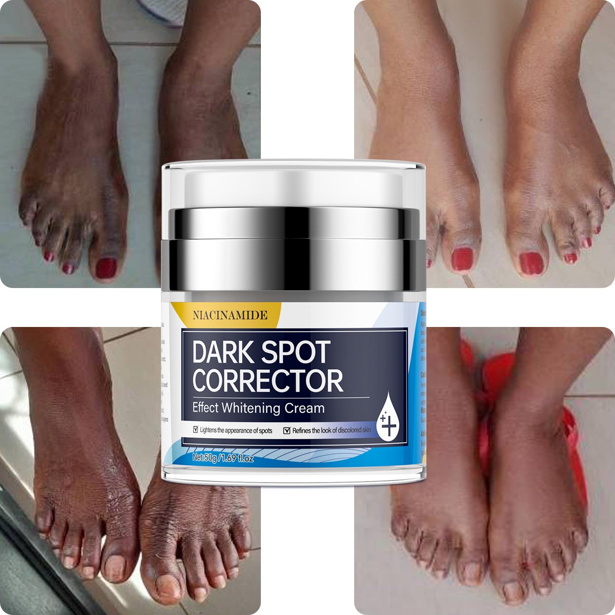 Facial Whitening Cream Lightening Bleach Anti-aging Face Cream Bleaching Freckle Anti-spot Cream