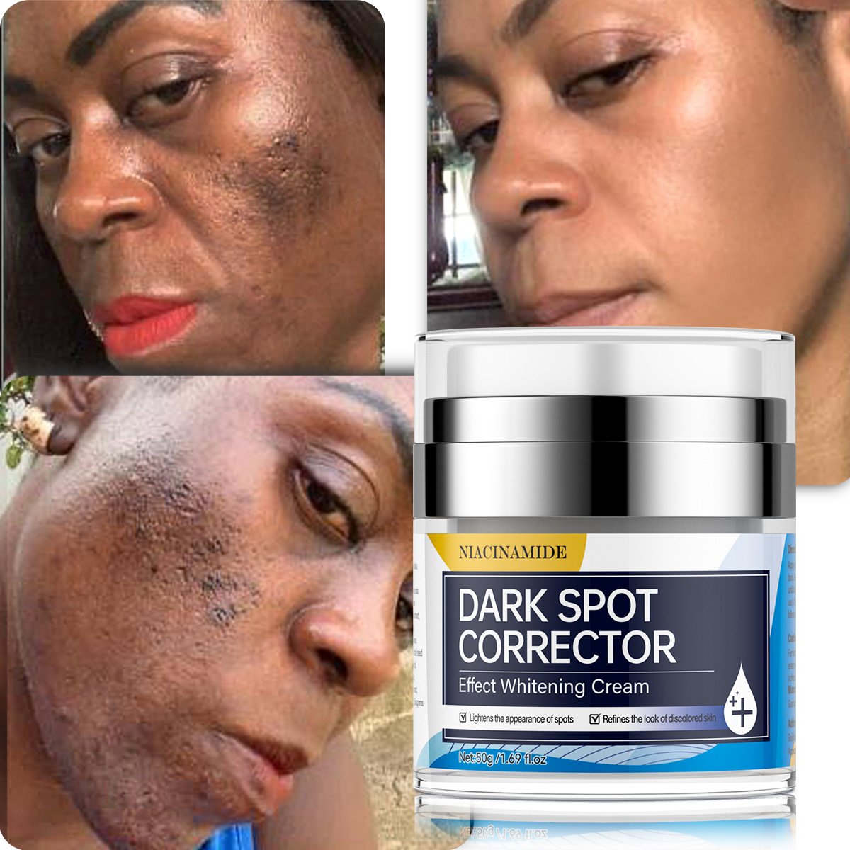 Facial Whitening Cream Lightening Bleach Anti-aging Face Cream Bleaching Freckle Anti-spot Cream
