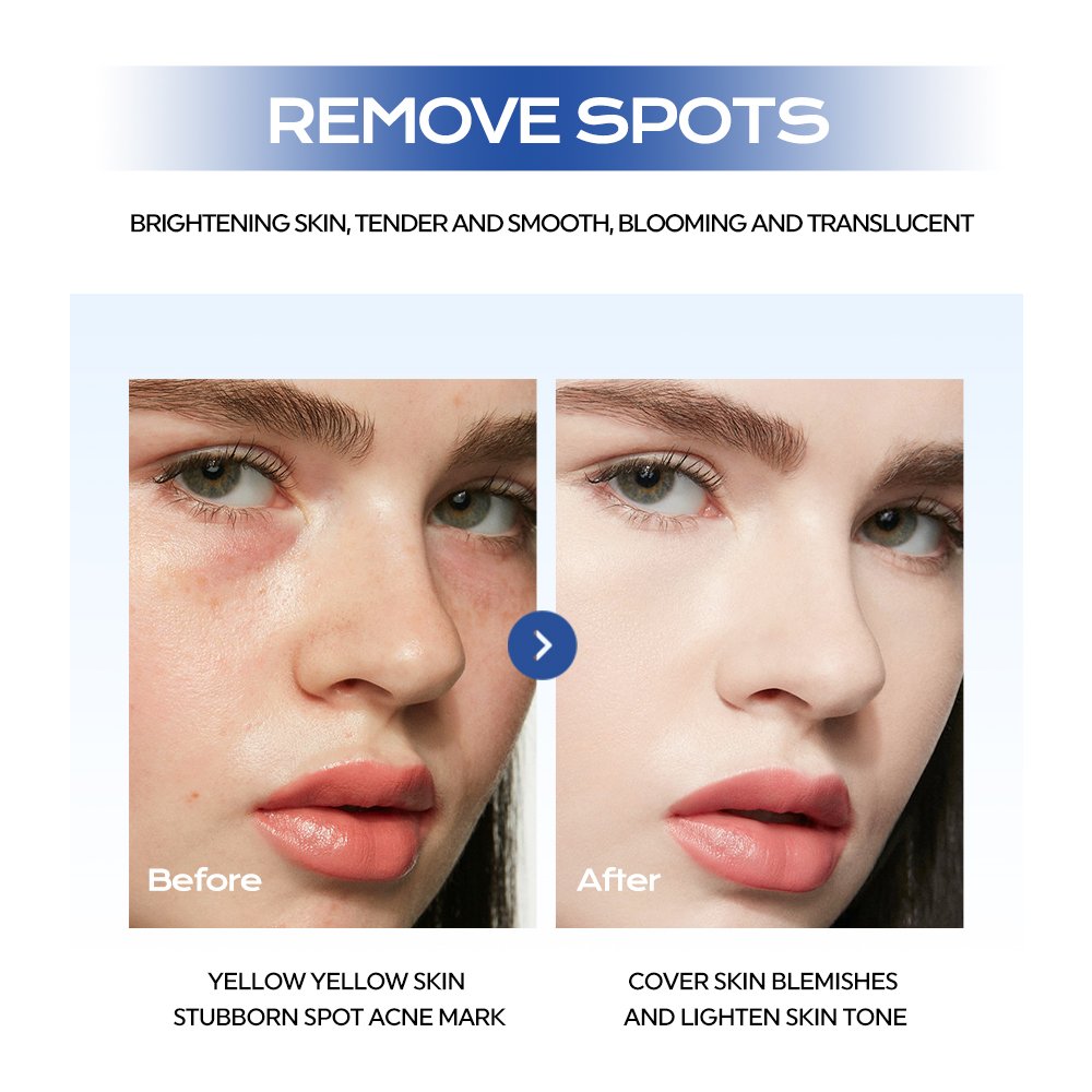 Wholesale Factory Price Women's Niacinamide Face Cream Moisturizing Whitening Cream for Freckle Removal and Face Care