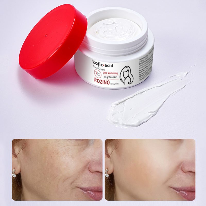 Skin Anti wrinkle Moisturizing and Desalinating Melanin Kojic Acid face cream