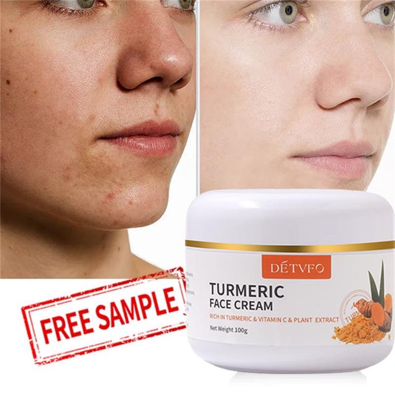 Turmeric whitening moisturizer herbal face cream blaching detvfo vitamin e anti aging whitening cream for face