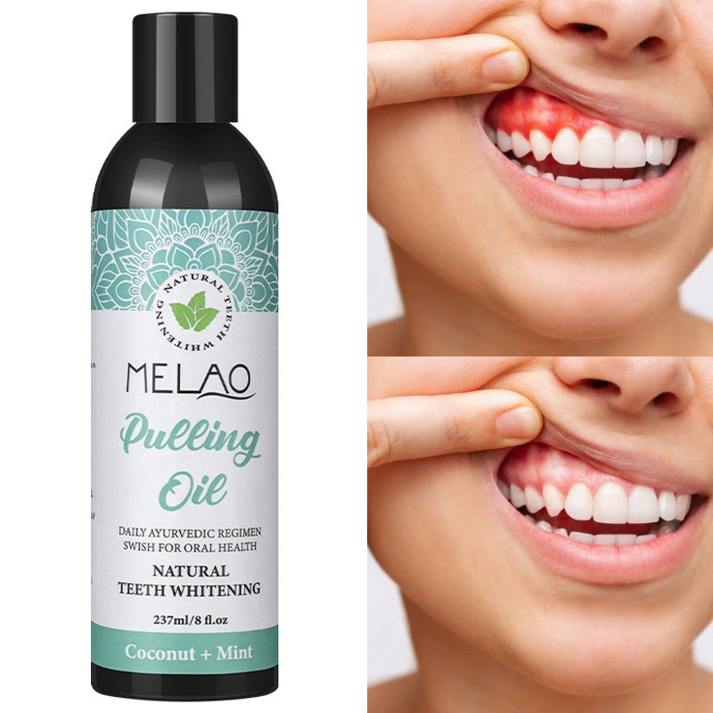 OEM Oral Oil Pulling with Coconut & Peppermint Oil Natural Alcohol Free Mouthwash Teeth Whitening and Healthier Teeth & Gums