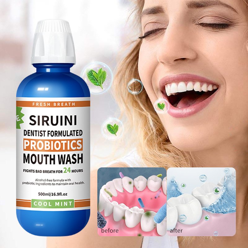 OEM Teeth Whitening Oral Care Mouth Wash Probiotic Ice Blue Cool Therabreath Mouthwash Oral Care Products Bad Breath Fresheners