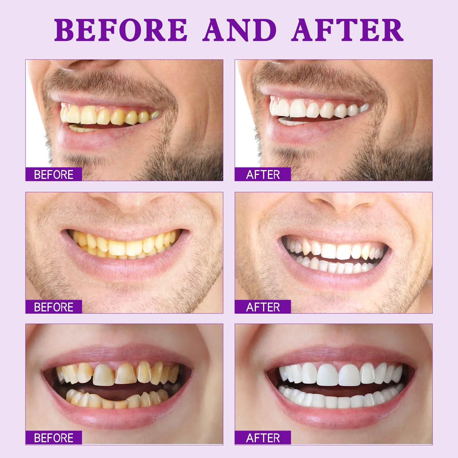 Yayashi Sp-7 Probiotic Whitening Toothpaste High Quality Oral Freshening And Breath Improvement For Yellow Tooth Stains Brighten