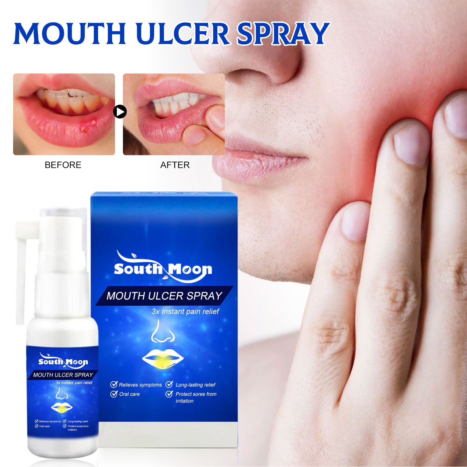 South Moon 30ml Mouth Ulcer Spray Relieve Periodontal Blister Bad Breath Gum Ache Relief Oral Pain Swelling Care Spray