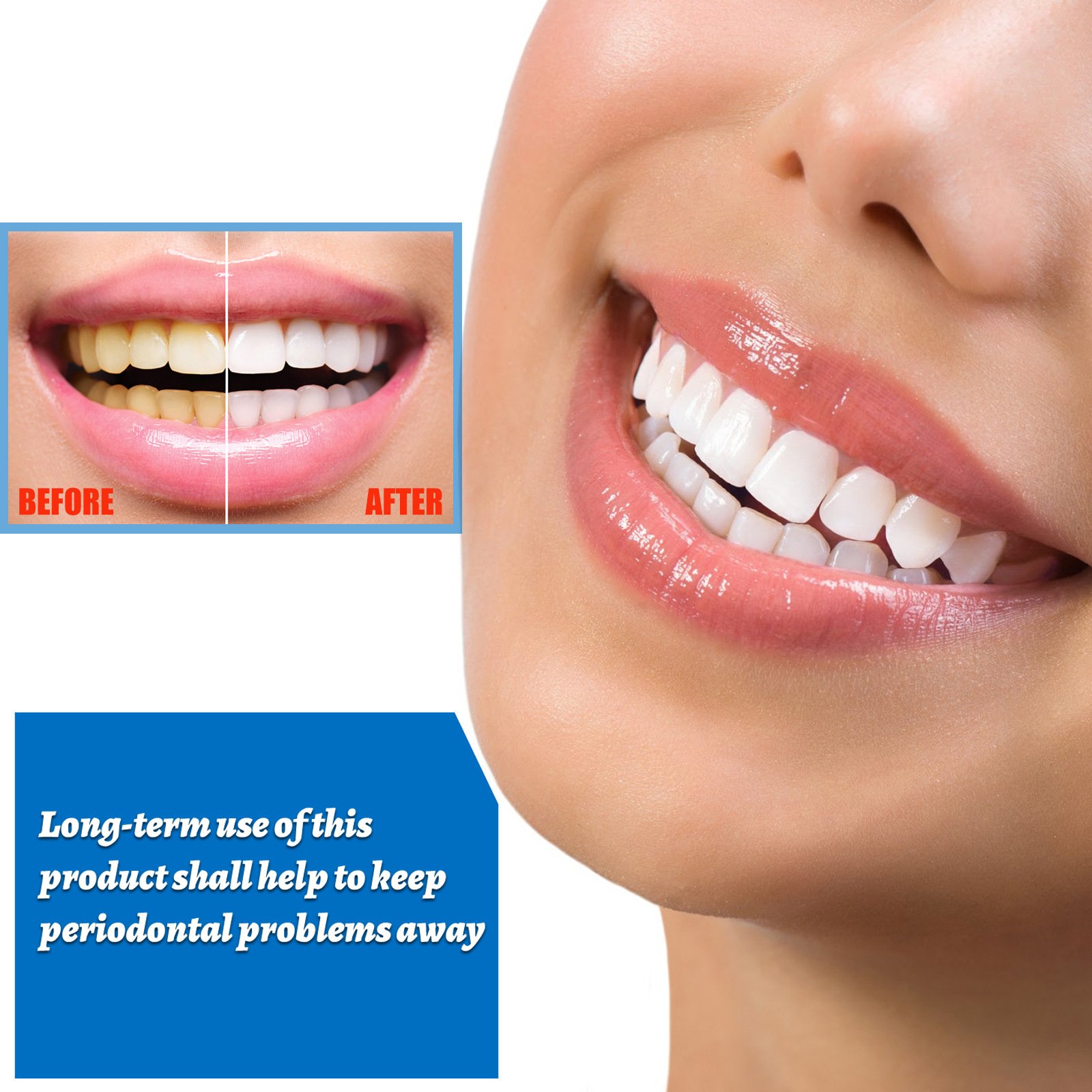 Teeth Whitening Serum effectively removes yellow spots, tobacco stains, deep plaque and freshens breath and oral hygiene HH