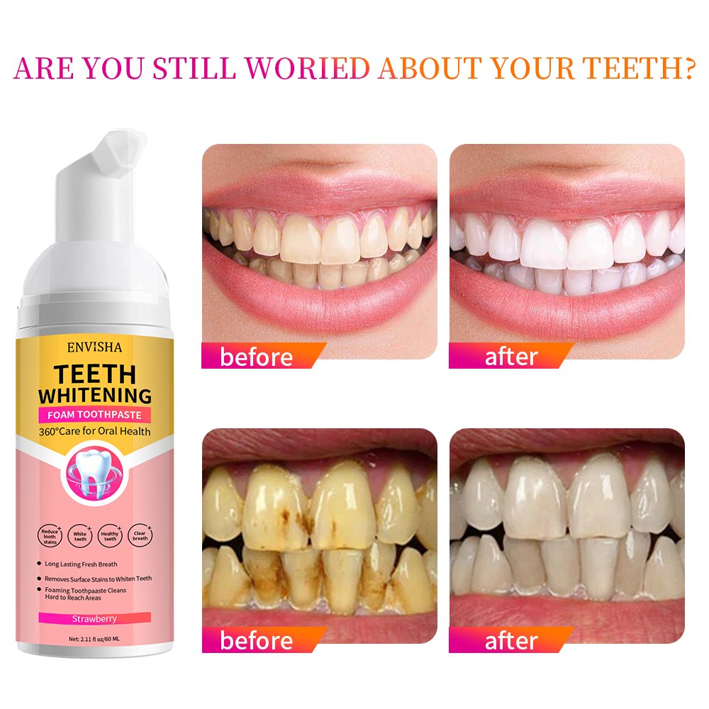 OEM ODM Daily Oral Care Tooth Stain Removal Foam Teeth Colour Correcting Whitening Mousse Toothpaste