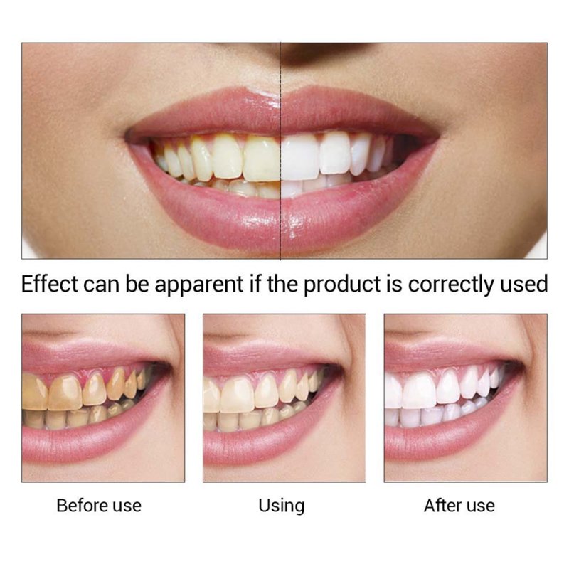 Teeth brightening whitening mousse foam anti-moth mouth cleaning serum for yellow smoking dirt teeth