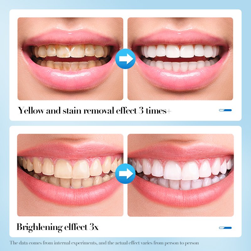 SADOER Private Label 60ml Foam Toothpaste Mint Flavor Tooth Mousse Teeth Whitening cleaning Foam For Daily Dental Care