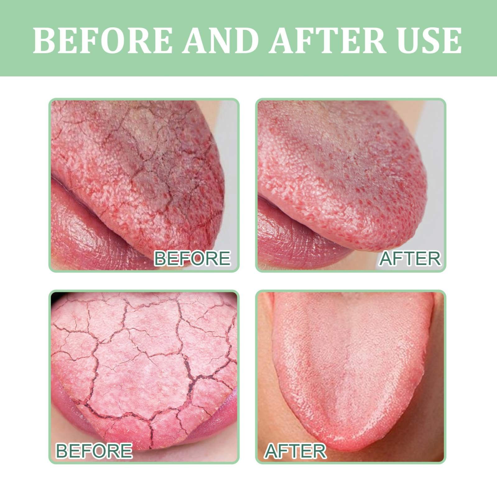 Prevent Mouth Dry Thirsty Portable Mint Breath Freshener Bad Breath Remove Perfume Mist Mouth Odor Breath Control Oral Spray 8ml