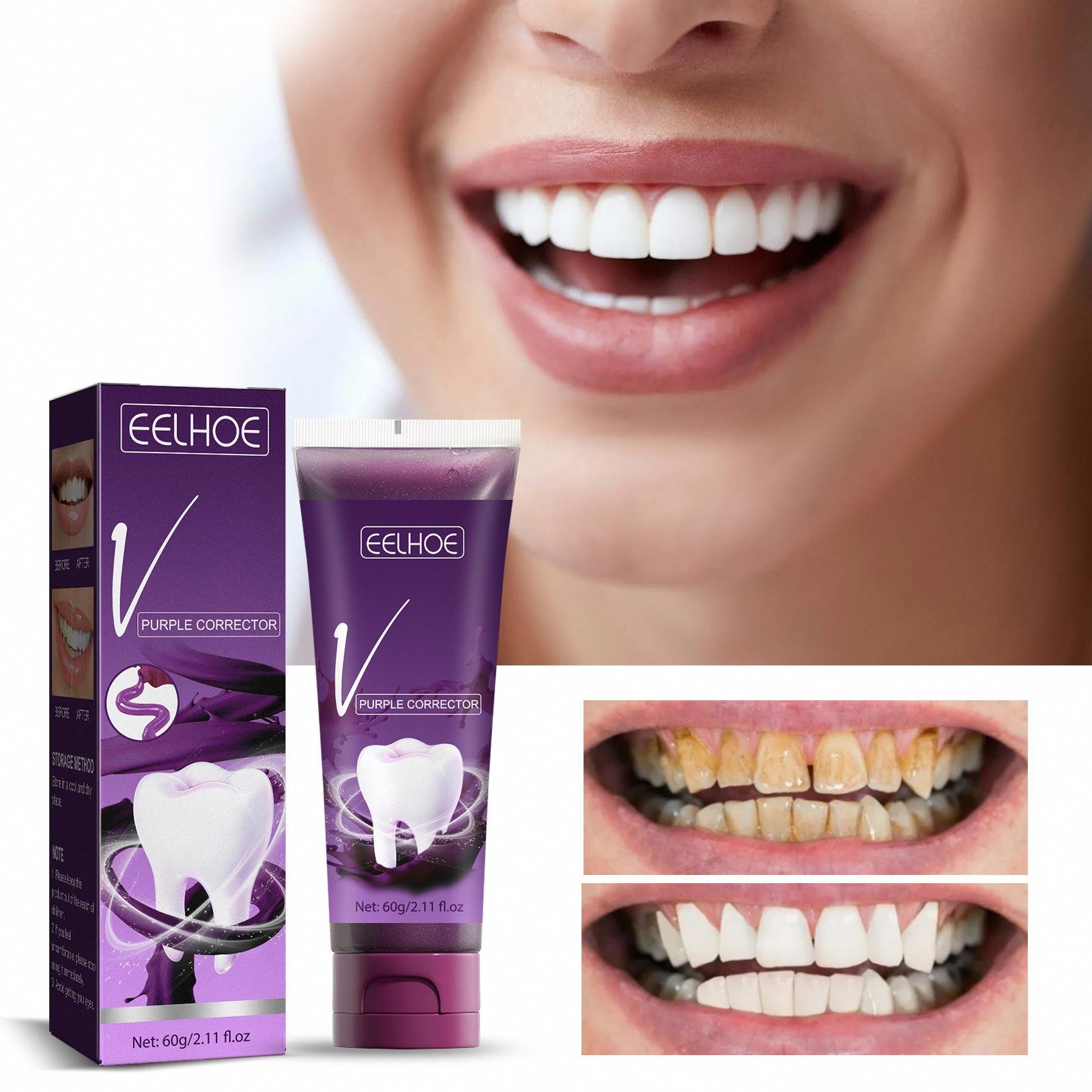 Costom OEM Teeth Whitening Mousse Dental Bleaching Deep Cleaning Removes Stains Dentistry Tool Breath Oral Hygiene Toothpaste