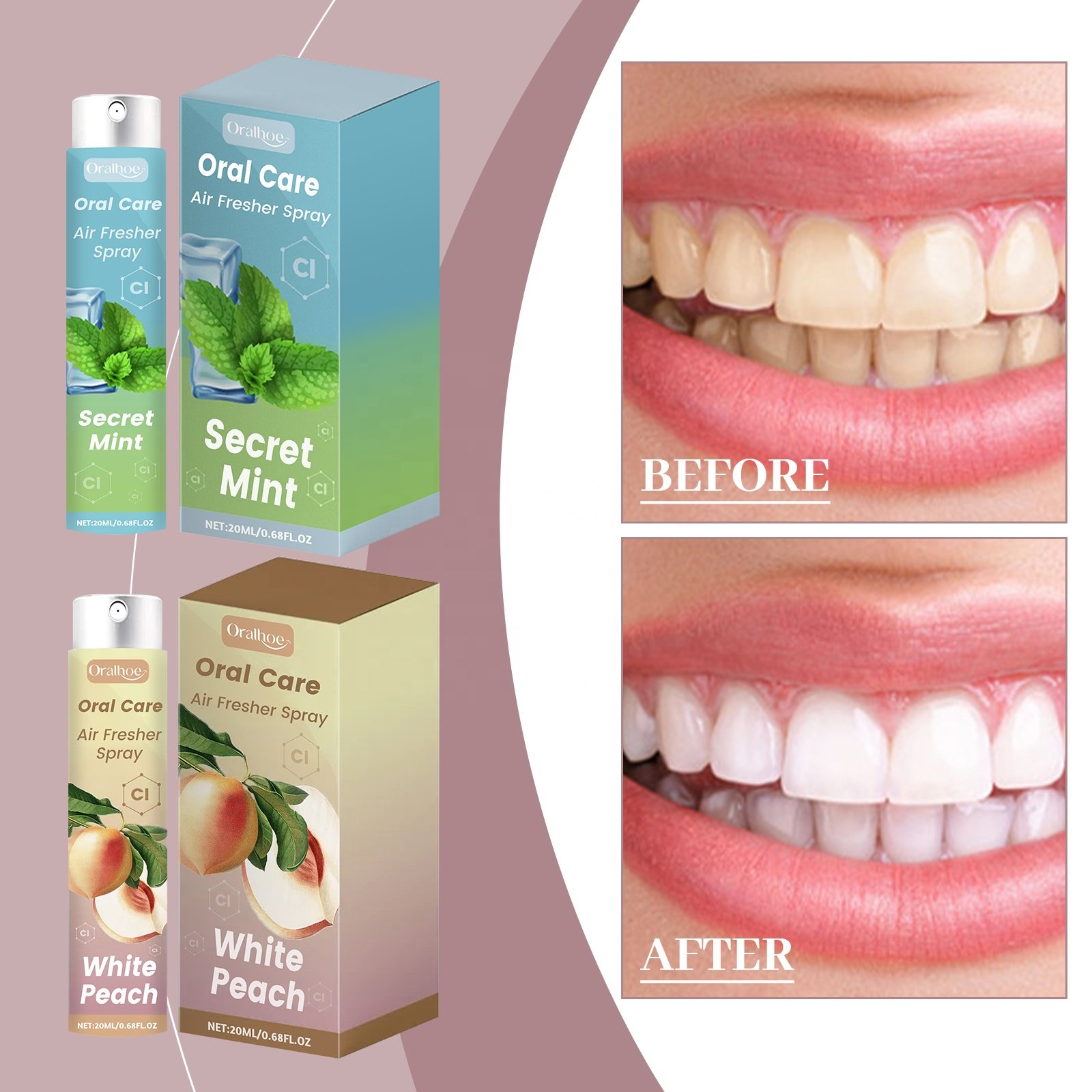 Private Label 100% Natural Oral Care Teeth Stains Bad Breath Remover White Peach Mint Fresh Breath Oral Mouth Freshener Spray