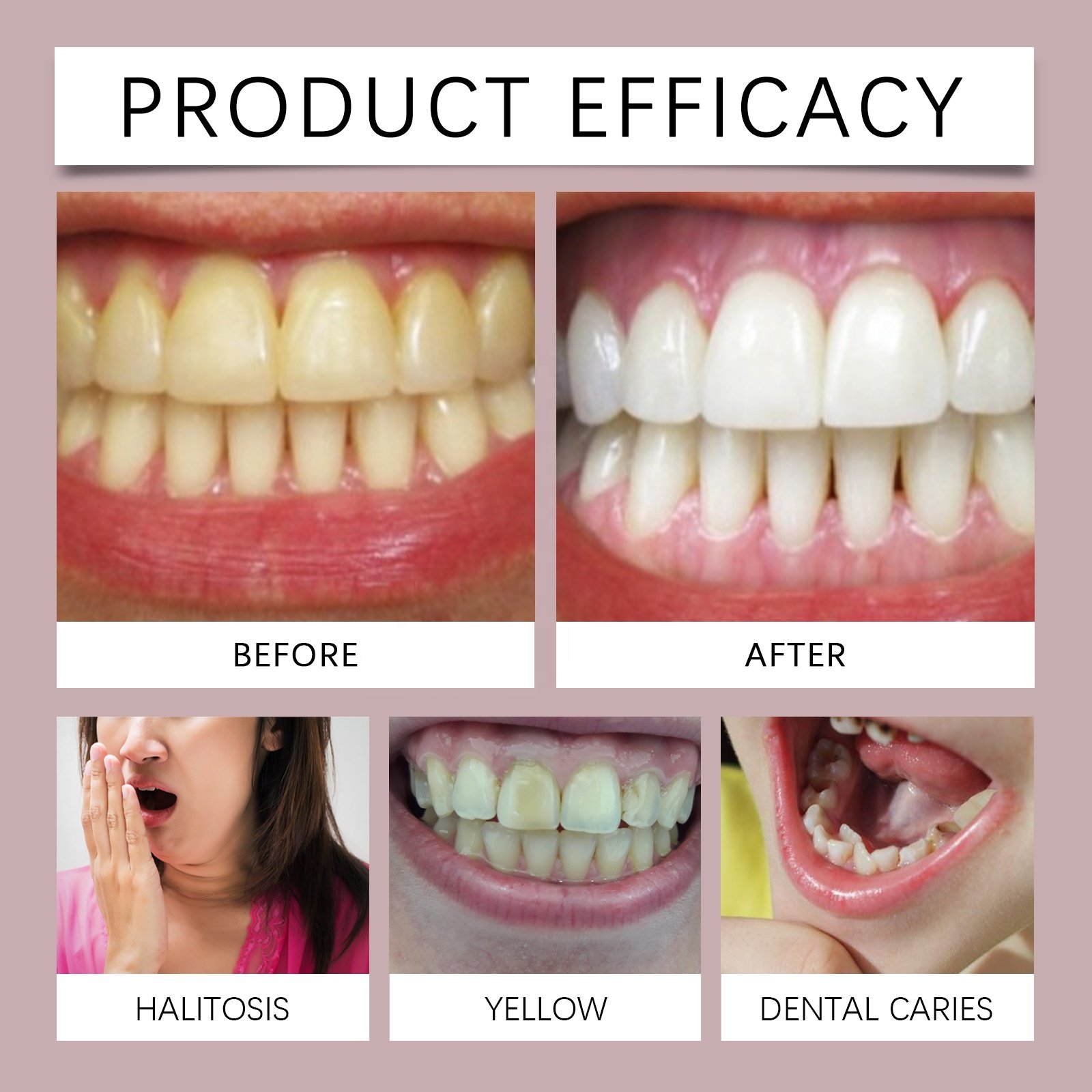 Private Label 100% Natural Oral Care Teeth Stains Bad Breath Remover White Peach Mint Fresh Breath Oral Mouth Freshener Spray