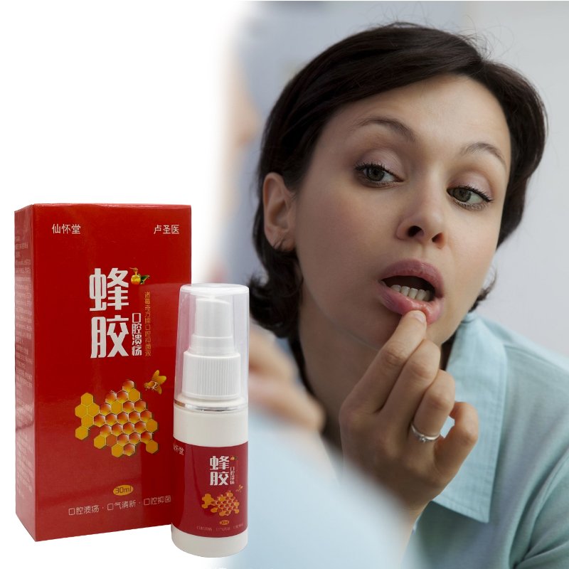 30ml Propolis Mouth Clean Oral Spray Treats Canker Sores Toothaches Pharyngitis Halitosis Freshens Breath