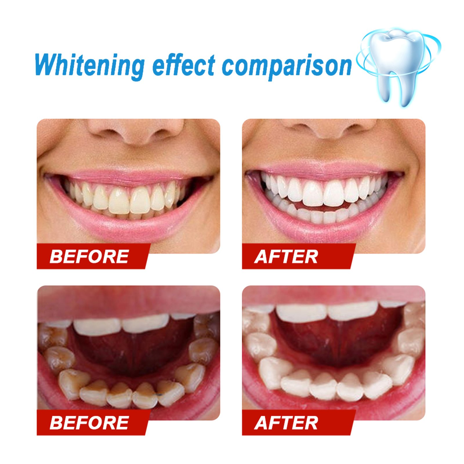 Professional Custom Dental 3ml Teeth Whitening Gel Press Pen Twist Teeth Whitening Pen