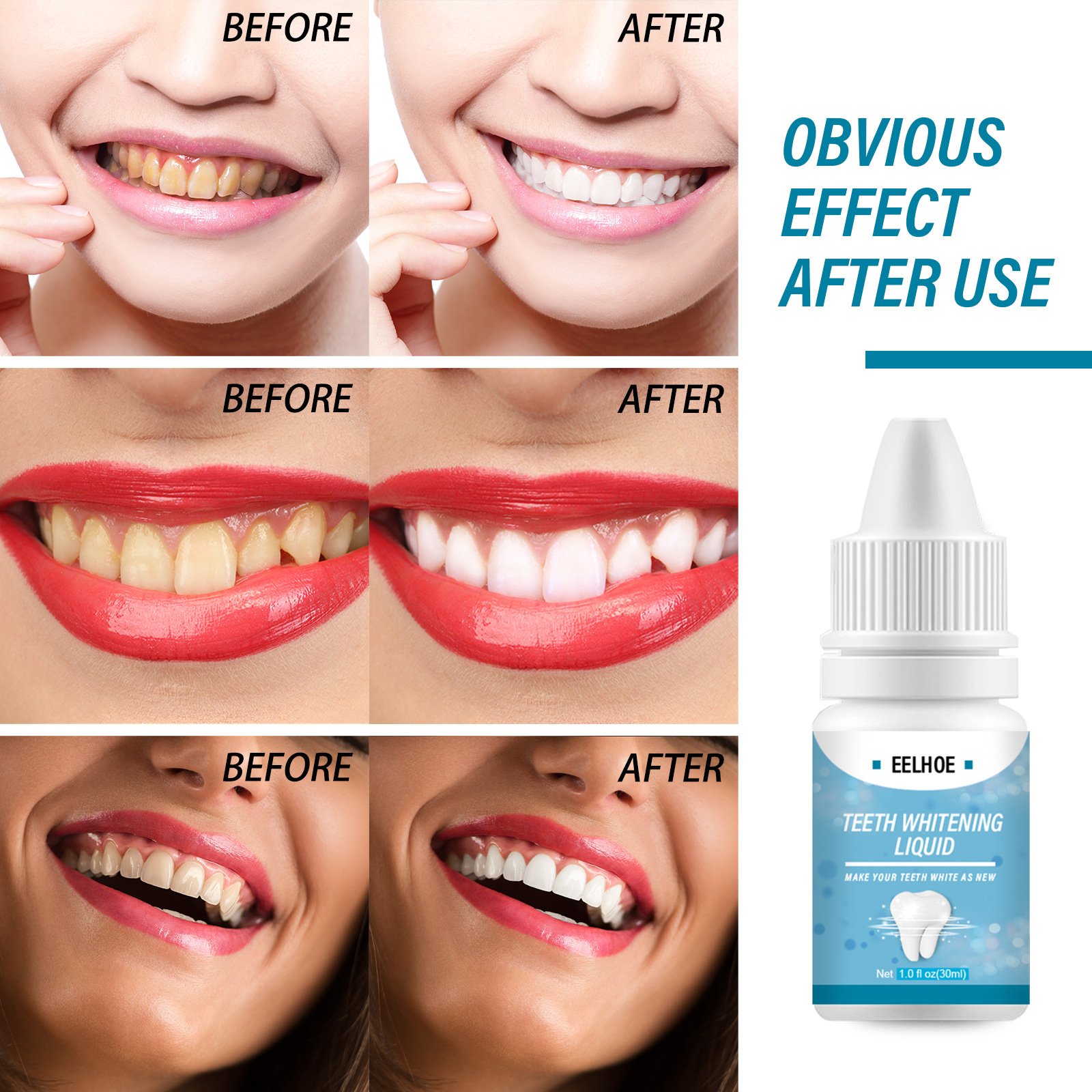Remove yellow teeth black teeth cigarette stains freshen breath whiten and brigh tooth whitening liquid