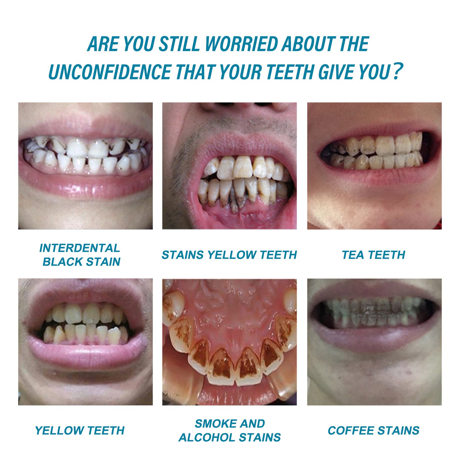 Remove yellow teeth black teeth cigarette stains freshen breath whiten and brigh tooth whitening liquid