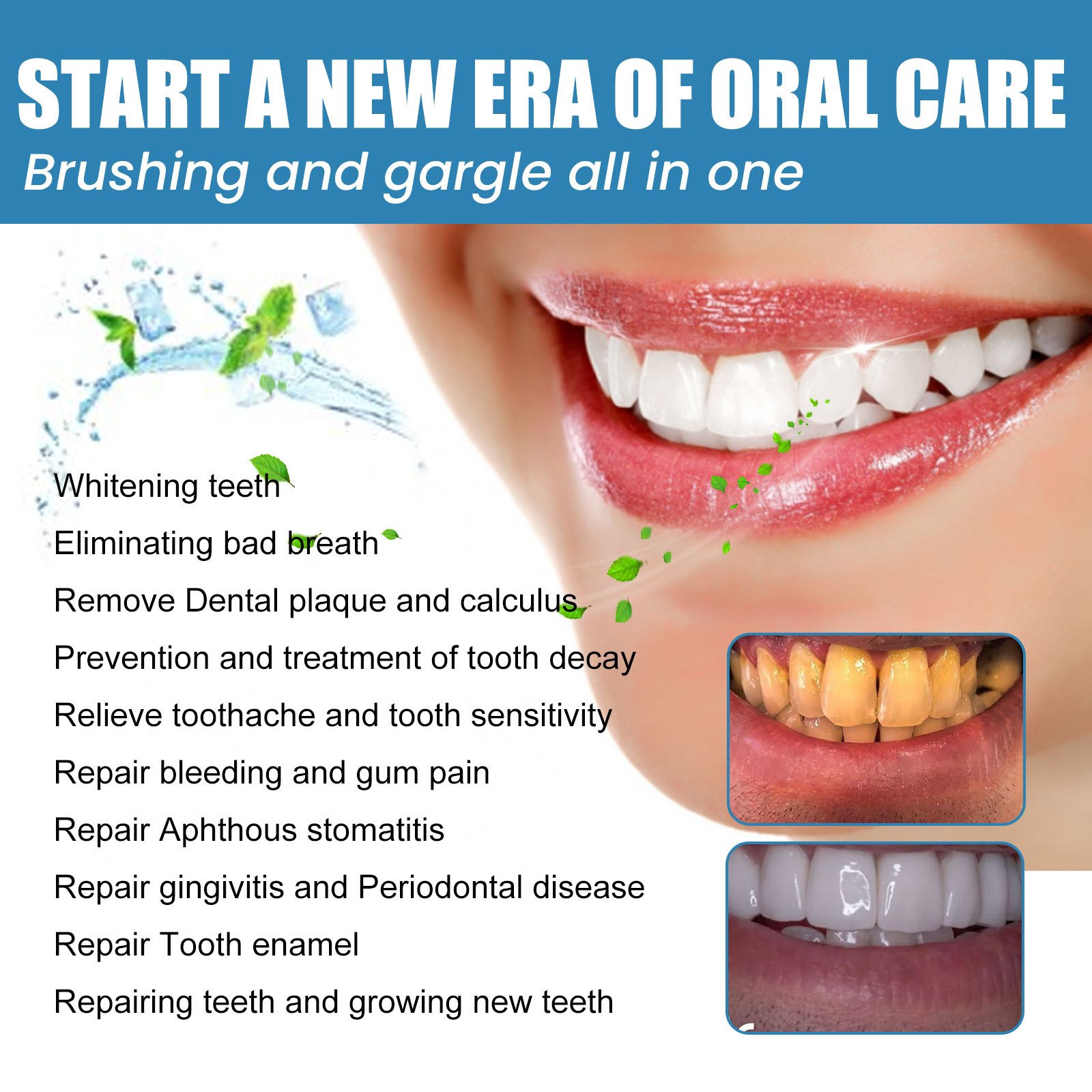 Mouthwash Disposable portable mouthwash for deep cleaning of teeth stains, dental calculus and breath freshening
