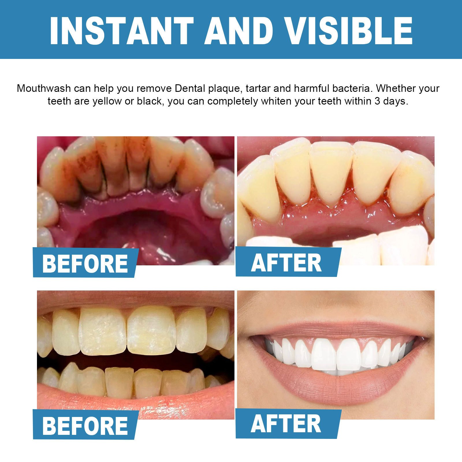 Mouthwash Disposable portable mouthwash for deep cleaning of teeth stains, dental calculus and breath freshening