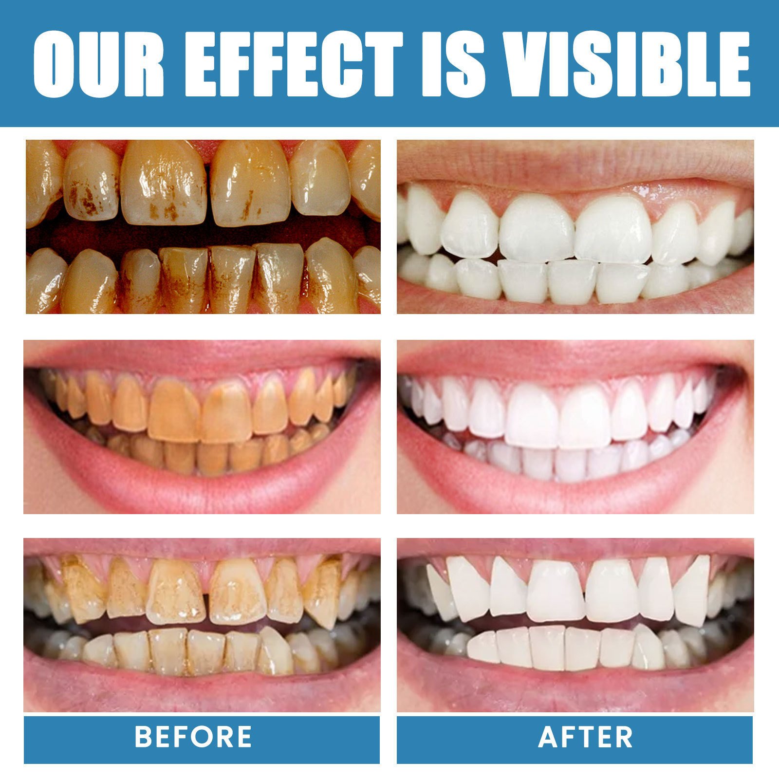 Mouthwash Disposable portable mouthwash for deep cleaning of teeth stains, dental calculus and breath freshening