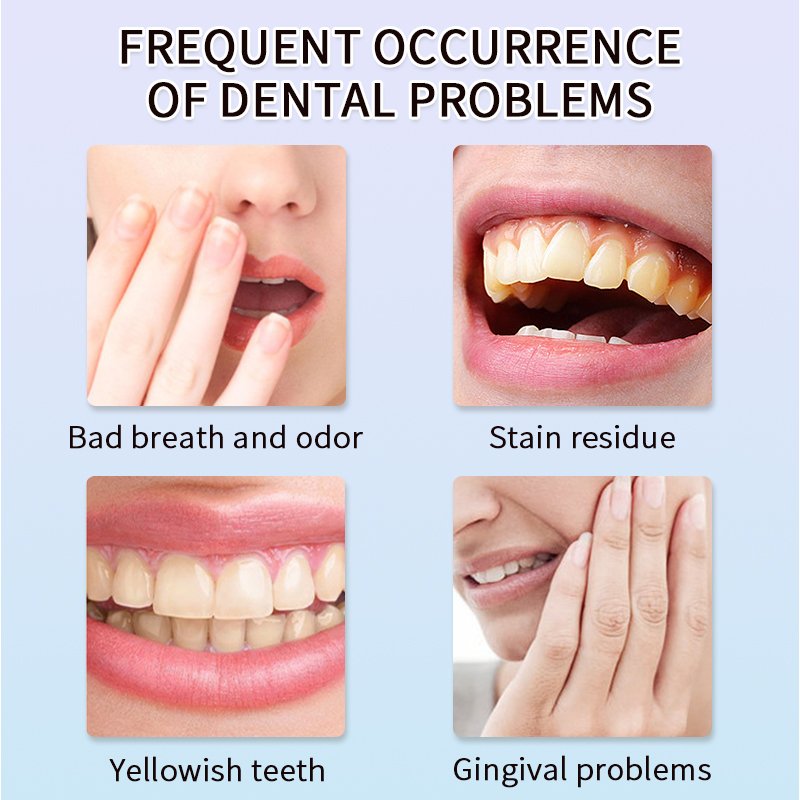 Wholesale whitening fresh breath nicotinamide whitening tartar removing toothpaste