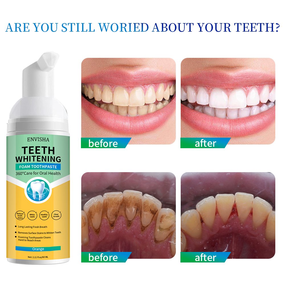 Teeth Whitening Mousse Tooth Whitening Deep Cleaning White Teeth Oral Hygiene Toothpaste Bleaching Remove Stains Dental Tool