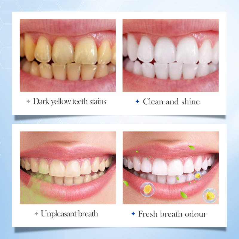 24K pure Gold toothpaste Reduce Yellowing Care For Teeth Gum Whitening Toothpaste Remove Stains Fresh Breath Brightening Teeth