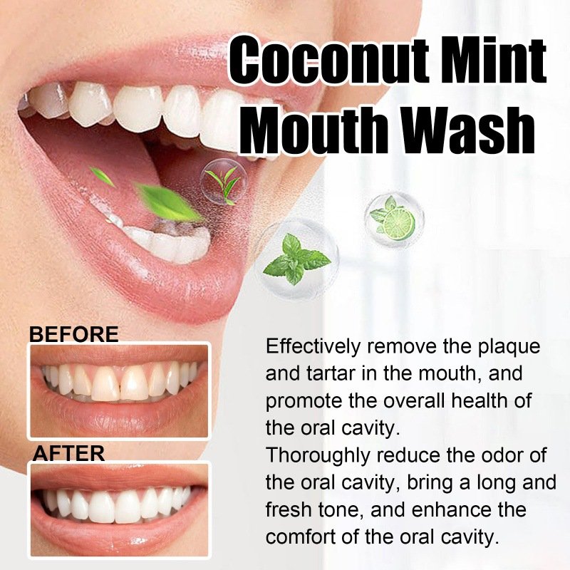 Hot Selling Coconut Oil Pulling Natural Essential Oil and Vitamin E Alcohol Free Mouthwash Fresh Breath Teeth Whitening Oil