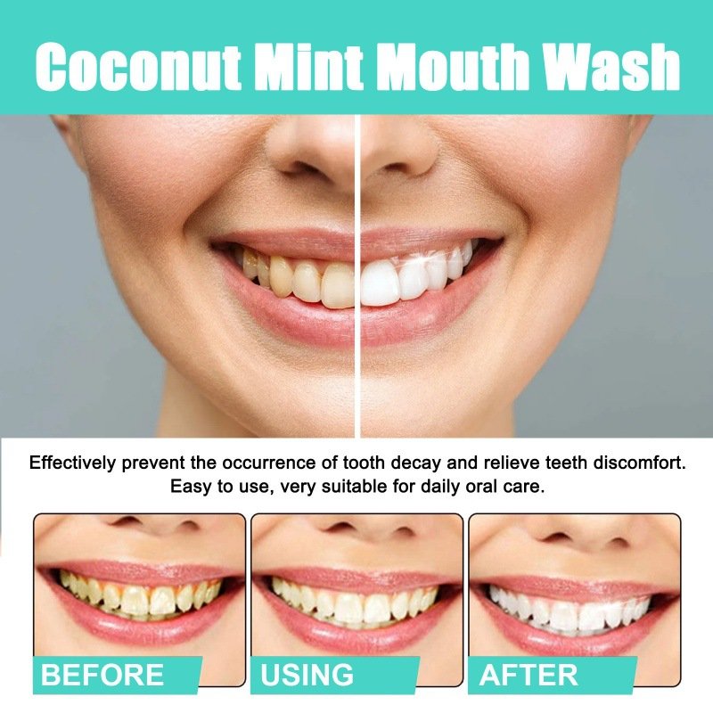Hot Selling Coconut Oil Pulling Natural Essential Oil and Vitamin E Alcohol Free Mouthwash Fresh Breath Teeth Whitening Oil