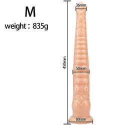 xl