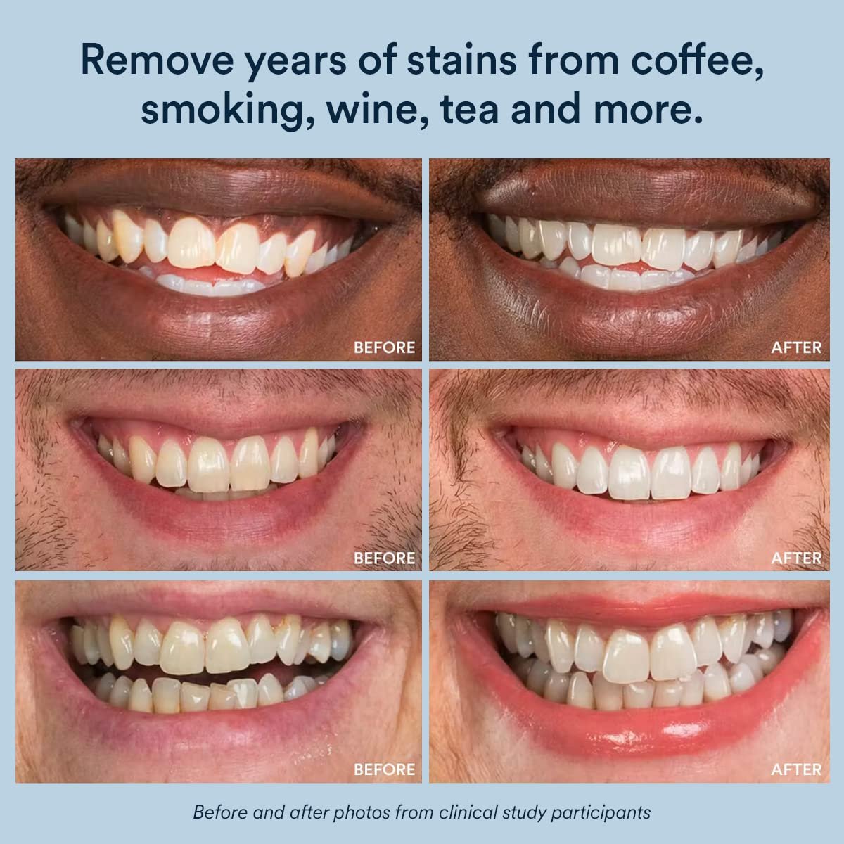 Best Seller 7 Pairs Dental Care Private Logo Teeth Whitening Strips For Daily Home Use