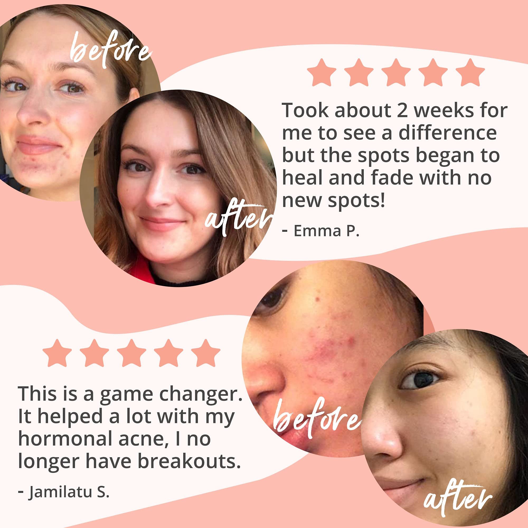 Acne supplement Skin Care Acne Cleanse Capsule Vegan Acne Capsule For Oily Skin Dark Spot skin whitening capsules