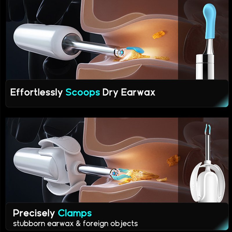Bebird H30S HD Endoscopic Camera AI Health Assistant Hearing Protection Home Ear Cleaning Kit