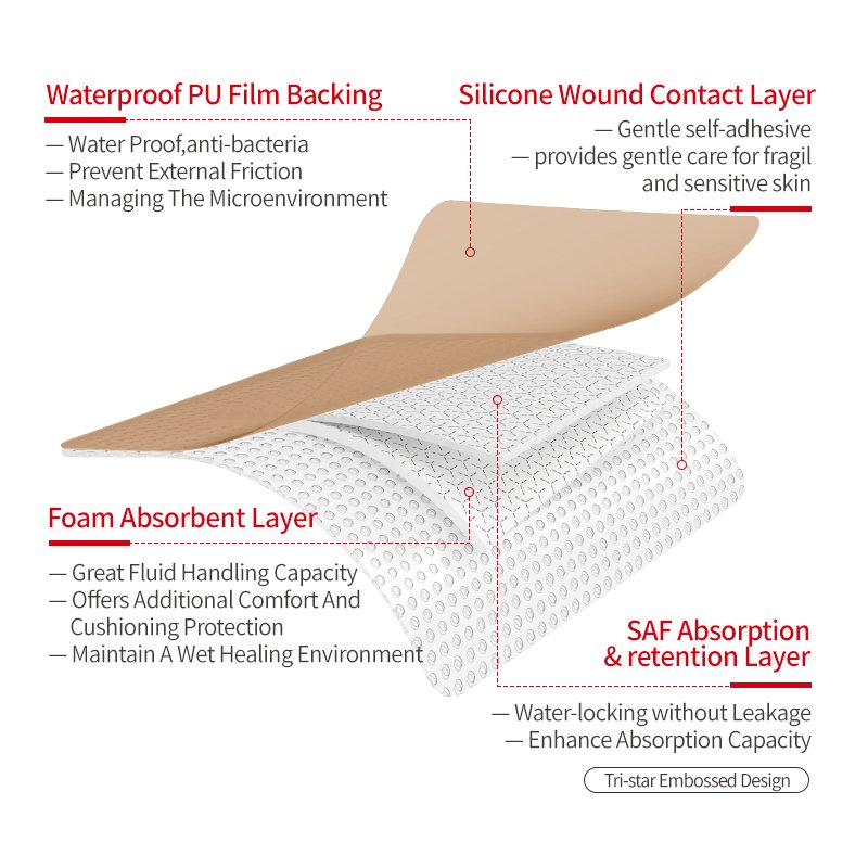 Alexer Bordered Silicone Adhesive Foam Dressing Medical for Bedsores Silicone Foam Dressing
