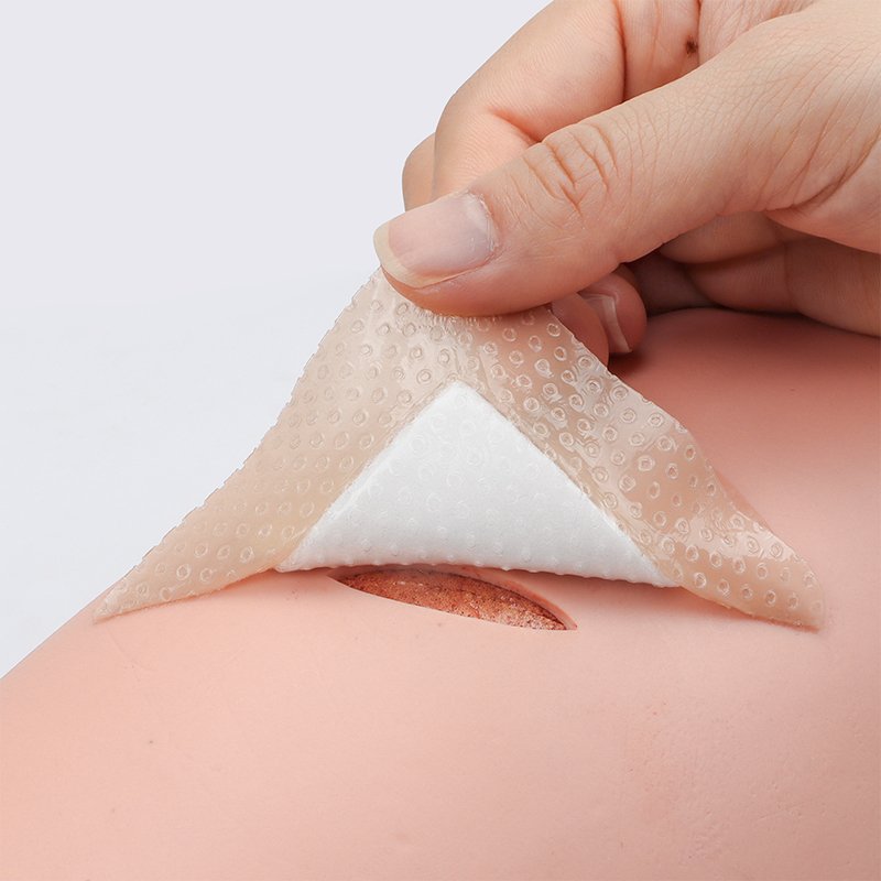 Alexer Bordered Silicone Adhesive Foam Dressing Medical for Bedsores Silicone Foam Dressing