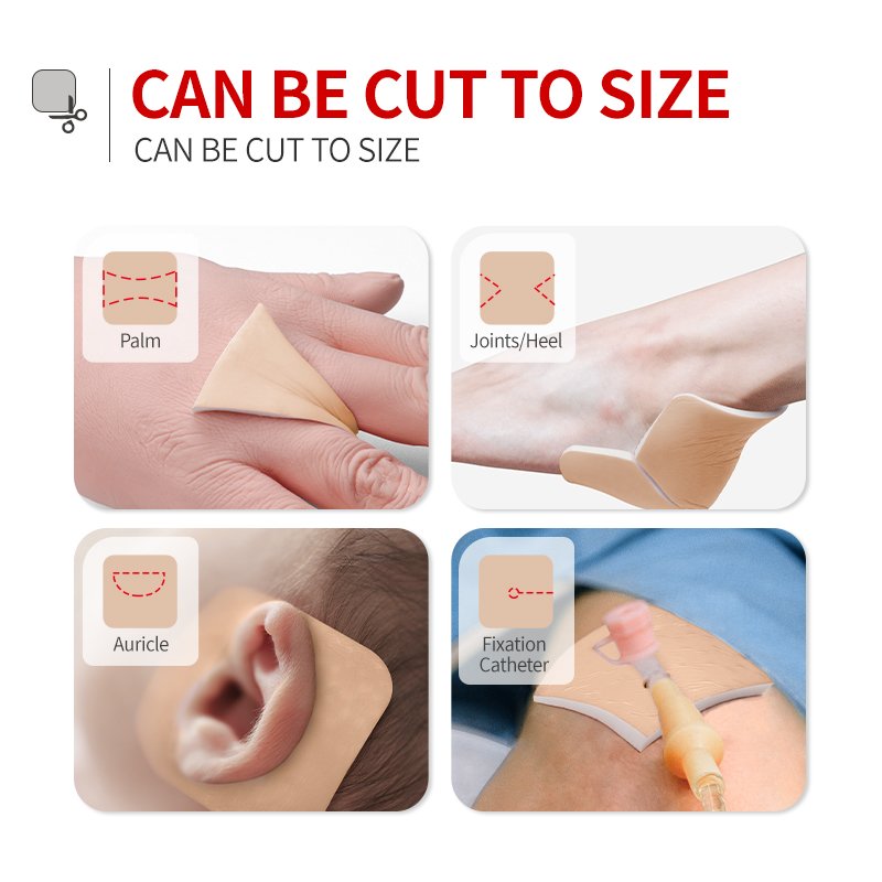 Alexer Non Adhesive Foam Dressing 5mm Thickness Soft PU Foam Dressing with Foam Pads