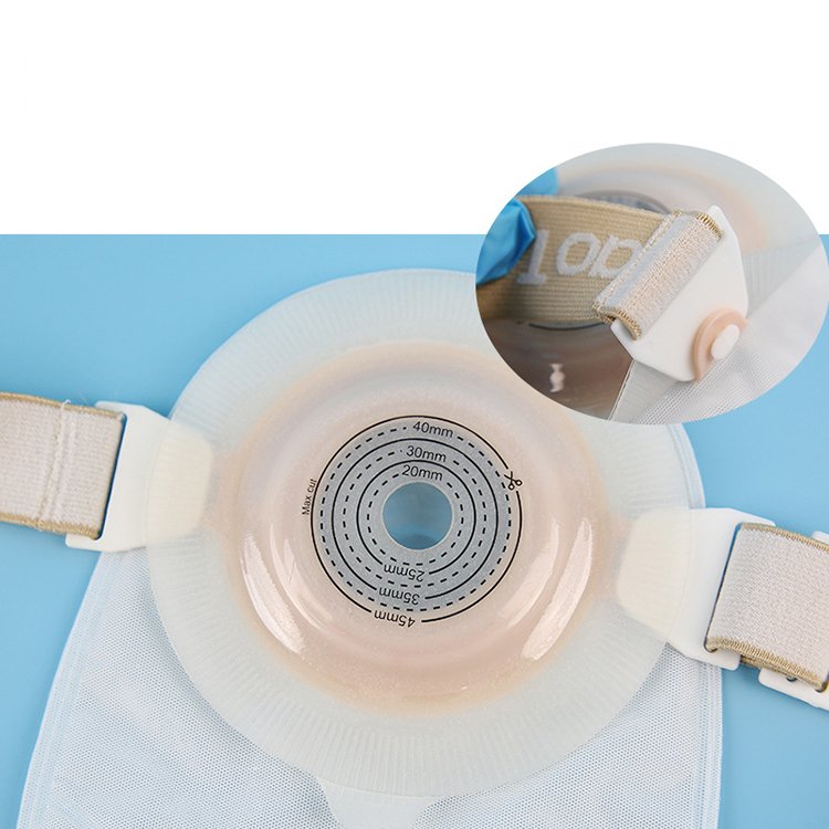 manufacture custom two piece urostomy connector to urine drain bag 25mm 50mm 57mm hole with adhesive
