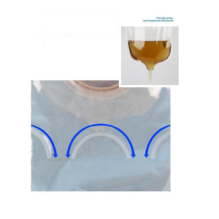 manufacture custom two piece urostomy connector to urine drain bag 25mm 50mm 57mm hole with adhesive